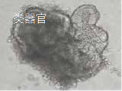 類器官