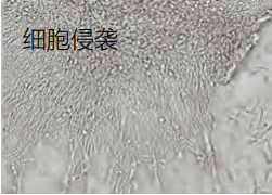 細胞侵襲