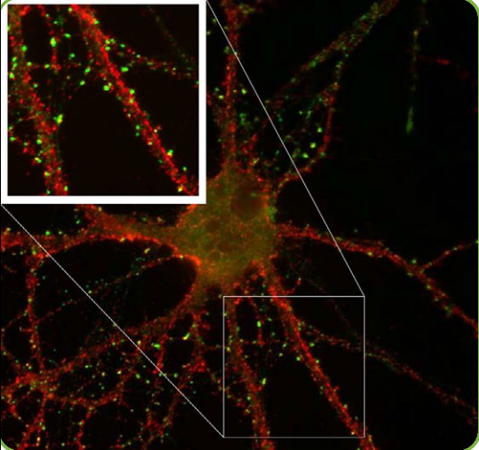 Antibodies-1.png