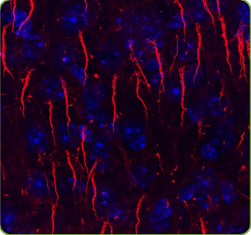 Antibodies-2.png
