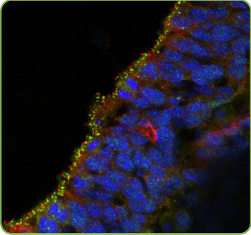 Antibodies-4.png