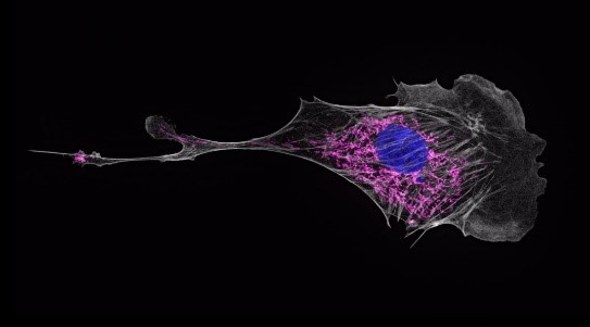 超高分辨顯微鏡(Super-resolution Microscopy)成像