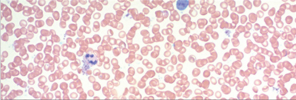 Giemsa-Stain-Kit.jpg