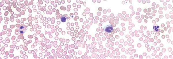 Quick-Dip-Differential-Stain-Kit.jpg