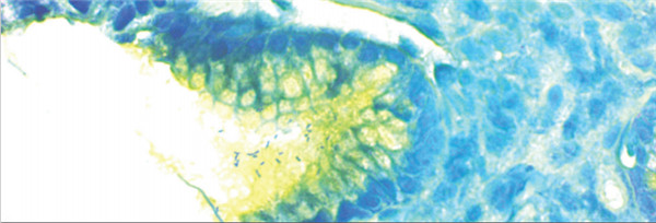 H.-Pylori-Stain-Kit.jpg