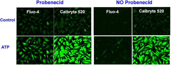 加或者不加丙磺舒（probenecid）對Fluo-4和Calbryte 520熒光標記結果的影響.jpg