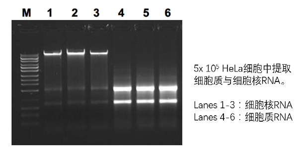 Hela細胞中提取細胞質與細胞核RNA.png
