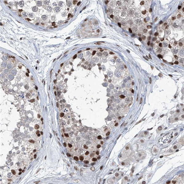 BMI1&nbsp;/ PCGF4.jpg