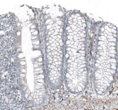 SALL4&nbsp;/ spalt-like transcription factor 4.jpg