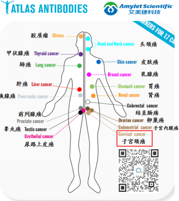 宮頸癌標志物.png