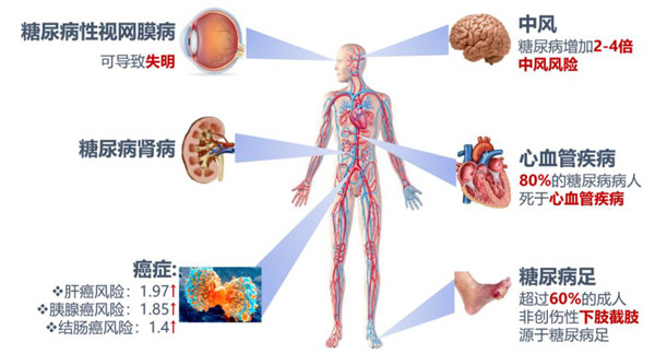 糖尿病相關并發癥.jpg