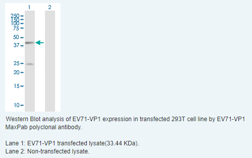 EV71-VP1抗體
