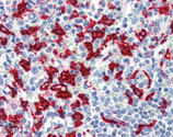 OSA-110_IHC.jpg