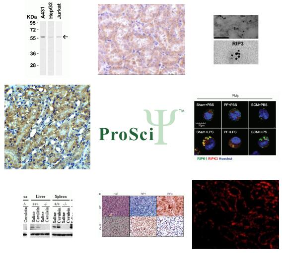 ProSci抗體