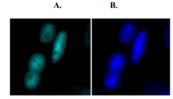 VU‐1免疫染色與PABPN1聚集物在人成肌細胞中共定位