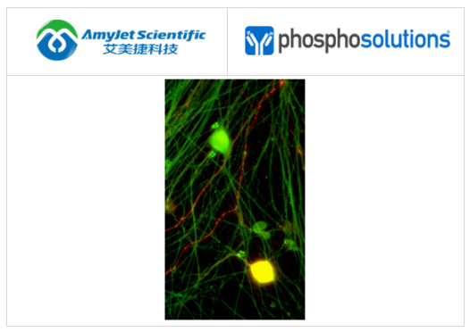 抗降鈣素基因相關肽 （CGRP） 抗體