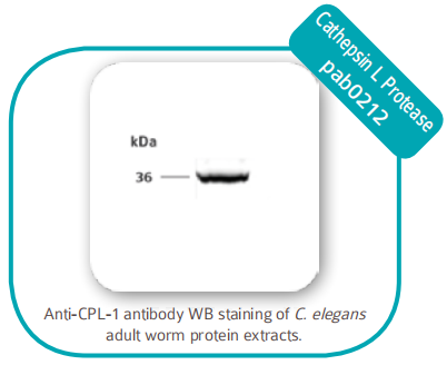 Chromatin IP 染色質免疫沉淀 