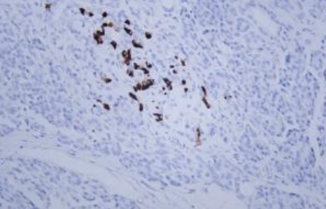 IHCAb Somatostatin (BGT232) 鼠單抗
