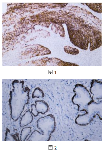 IHCAb CK14鼠單抗 (BGT047)