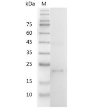 重組小鼠IL-12 p35的SDS-PAGE分析
