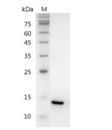 重組人白細胞介素-22的SDS-PAGE分析