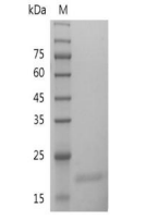 重組人IL-28A的SDS-PAGE分析