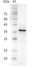 重組人CHI3L1的SDS-PAGE分析