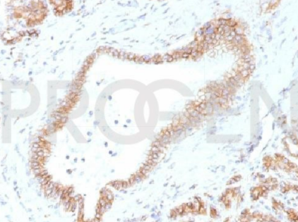 抗p120小鼠單克隆抗體，EBS-CA-011，純化