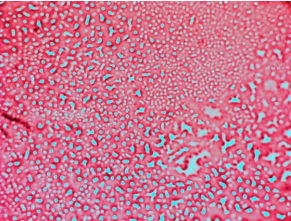HPB-Red 549 Mab.png