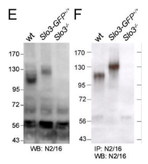 來自NeuroMab的抗KCNU1/Slo3 pH敏感的maxi-K+通道小鼠單克隆一抗是由雜交瘤克隆N2/16在內部生產的。它經過KO驗證，檢測小鼠、爪蟾KCNU1/Slo3 pH敏感的最大K+通道，并通過蛋白A色譜純化。它非常適合在EM、ICC、IP、WB中使用。     艾美捷NeuroMab抗KCNU1/Slo3 pH敏感性Maxi-K+通道抗體（N2/16）：  貨號 75-056  目標：KCNU1/Slo3 pH敏感型最大K+通道  目標描述：由KCNU1基因編碼的鉀鈣激活通道亞家族U成員1是鉀通道家族的一員，屬于鈣激活的（TC 1.A.1.3）亞家族，KCa5.1/KCNU1次亞家族。KCNU1是一個睪丸特異性的鉀通道，通過細胞內pH和膜電壓激活，介導K+的運輸。KCNU1在睪丸中表達。與KCNU1相關的疾病包括腦白質營養不良、低髓鞘化3型和Coffin-Siris綜合征1型。  格式：通過蛋白A色譜法純化  濃度：1毫克/毫升  克隆性：單克隆  克隆：N2/16  亞型：IgG1  應用：電鏡（EM）、免疫細胞化學（ICC）、免疫沉淀（IP）、西方印跡（WB）  宿主物種：小鼠  基因名稱：Kcnu1 Kcnma3 Ksper Slo3  分子量：115千道爾頓  抗原：小鼠Slo3（訪問號O54982）的融合蛋白氨基酸1052-1121，在大腸桿菌中重組產生  物種反應性：沙鼠、小鼠  儲存：分裝后在-20°C以下長期儲存。短期儲存在2-8°C。為了最大限度地恢復產品，取下蓋子前先離心管。  物理狀態：液體  生產說明：通過體外生物反應器培養雜交瘤細胞系，然后通過蛋白A親和色譜法生產。純化的單克隆抗體特異性抗體超過90%。  緩沖液：10 mM Tris，50 mM 氯化鈉，0.065% 疊氮化鈉 pH 7.4  稀釋范圍：WB: 1:500  偶聯物：未偶聯  特異性：未報告交叉反應  質量控制：每批新抗體都在過表達目標蛋白的細胞上進行質量控制測試，并確認給出預期的染色模式。  使用說明：這些抗體用作研究實驗室試劑，不用于人類診斷或治療試劑。  有效期：自收貨之日起24個月  運輸：冰袋運輸  同義詞：鉀通道亞家族U成員1（鈣激活鉀通道亞單位α-3）（鈣激活鉀通道，亞家族M亞單位α-3）（精子特異性堿化激活K(+)電流的孔形成亞單位）（KSper）（Slowpoke同源物3）（mSlo3）（pH敏感型最大鉀通道）  UniProt詳情：UniProt（人類）: A8MYU2  UniProt（免疫原物種）: O54982  71.png  免疫印跡與來自野生型（wt）、Slo3-eGFP和Slo3-/-敲除小鼠睪丸的（E）膜蛋白以及用N2/16探測的N2/16拉下的總睪丸蛋白的（F）免疫沉淀產物的比較。數據由Christopher Lingle（華盛頓大學）提供，并經美國國家科學院院刊許可轉載（2011 Zeng等人，PMID 21427226）。     NeuroMab 旨在構建一個新的神經元蛋白庫。NeuroMab專注于研究膜蛋白（受體/通道/轉運）、突觸蛋白和其他神經元信號分子。隨后，NeuroMab逐漸擴大了其產品線的范圍，現在涵蓋了神經科學和生物醫學基礎研究的其他領域。NeuroMab為哺乳動物大腦的生化和免疫組織化學實驗提供低成本、高質量的小鼠單克隆抗體。目前NeuroMab已經開發了近500種抗體，其中許多已在小鼠腦中進行了敲除驗證。     艾美捷科技是NeuroMab的中國代理商，為科研工作者提供優質的產品與服務。