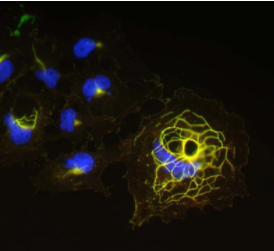 轉染細胞免疫熒光染色N22/21=綠色，兔抗Shank1=紅色，DAPI=藍色。