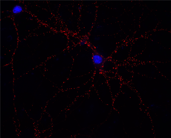 141 111AbRED.png