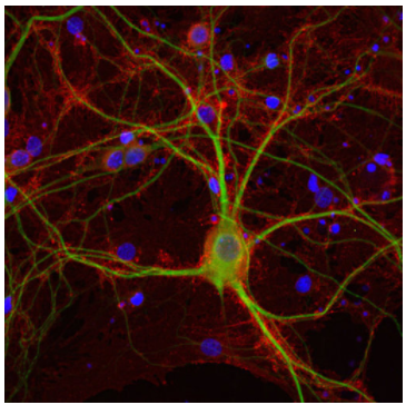 IHC-P-2.png