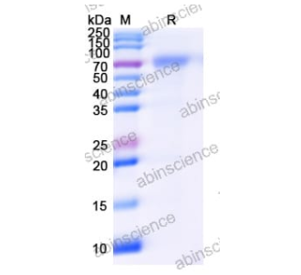 墨江病毒（Mojiang virus）是一種新興的病原體，其G蛋白（MojVGP5）在病毒的附著和感染過程中發揮重要作用
