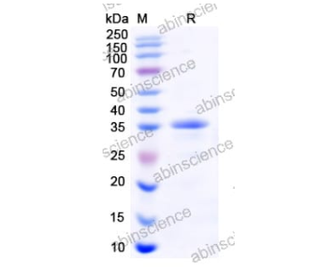 重組柯薩奇病毒A16 VP1蛋白是一種通過大腸桿菌（E. coli）表達系統生產的重組蛋白，其氨基酸序列范圍為Gly566-Leu862。