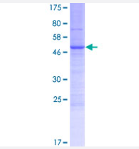 Western Blot（轉染裂解液）
