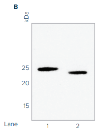 TMB.png