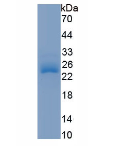 abx067740.png