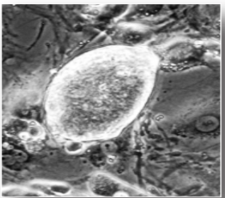 iPSCs.png