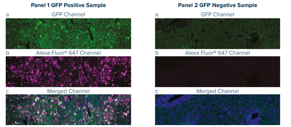 GFP.png