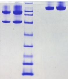 SDS-PAGE檢測