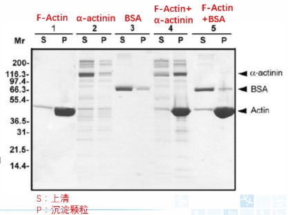 Actin結合蛋白分析試劑盒.jpg