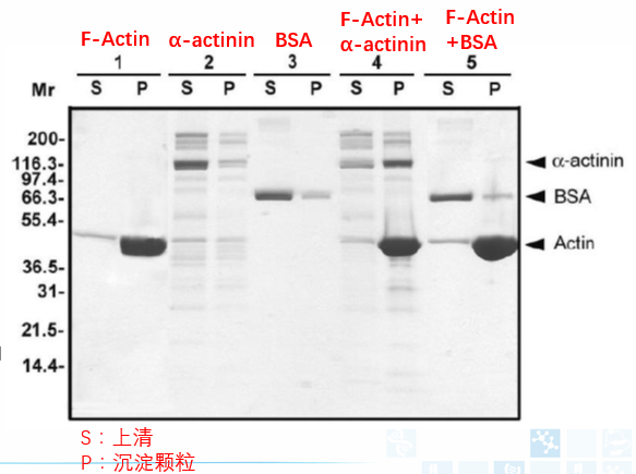 Actin結合蛋白分析試劑盒