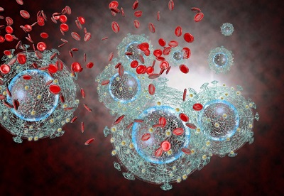 tumor-marker.jpg