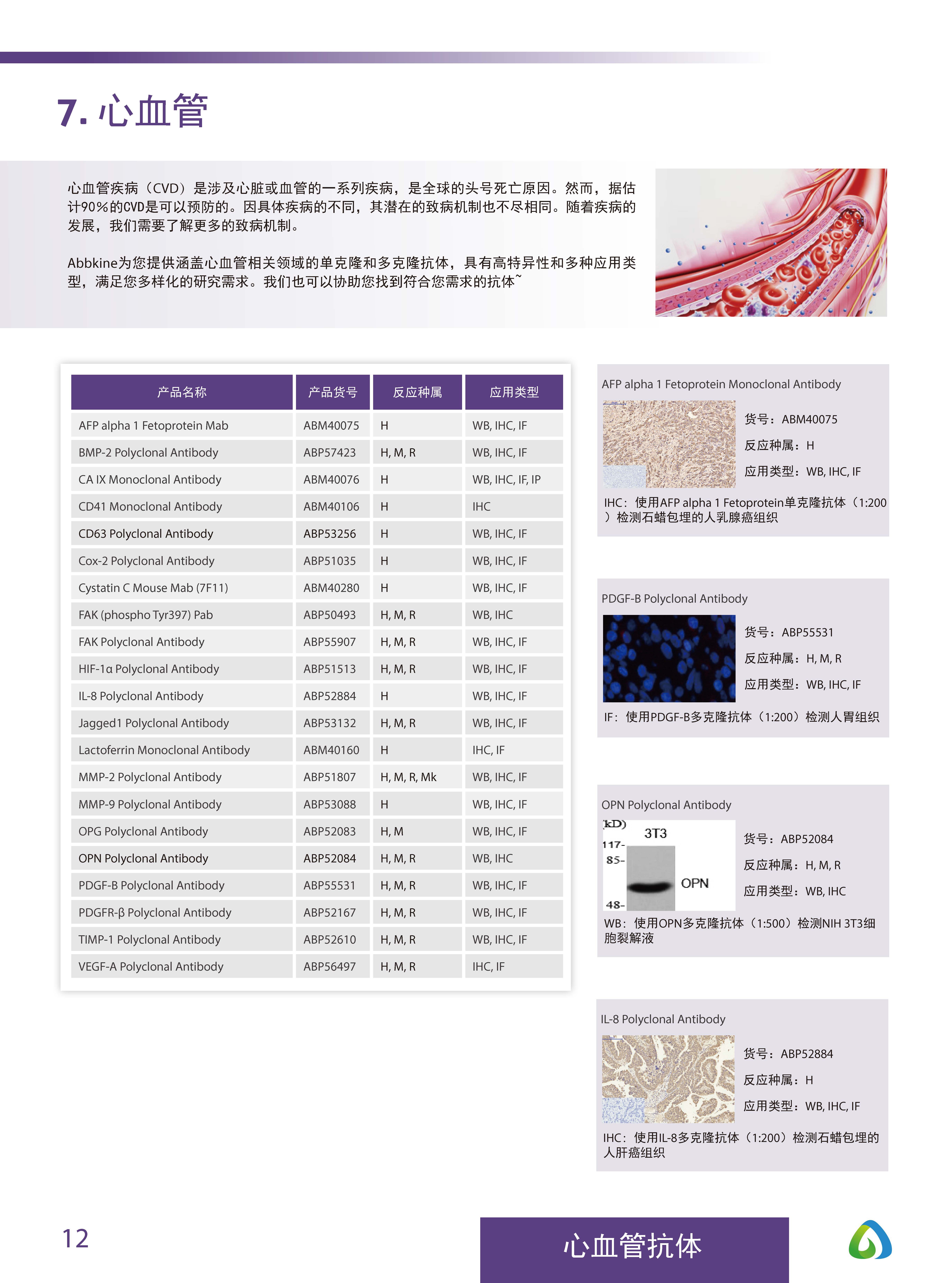 Abbkine“皇冠”抗體產品應用手冊